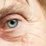 Cataratta cos'è e intervento chirurgico